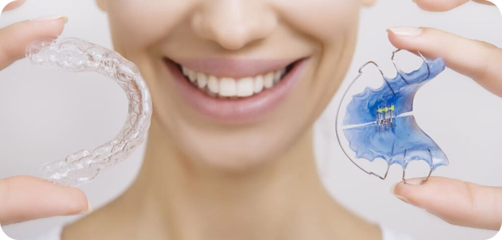 Types of Retainers Available At Pasha Orthodonticsg