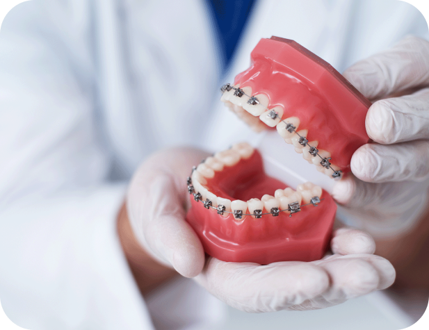 What Are Braces and How Do They Work